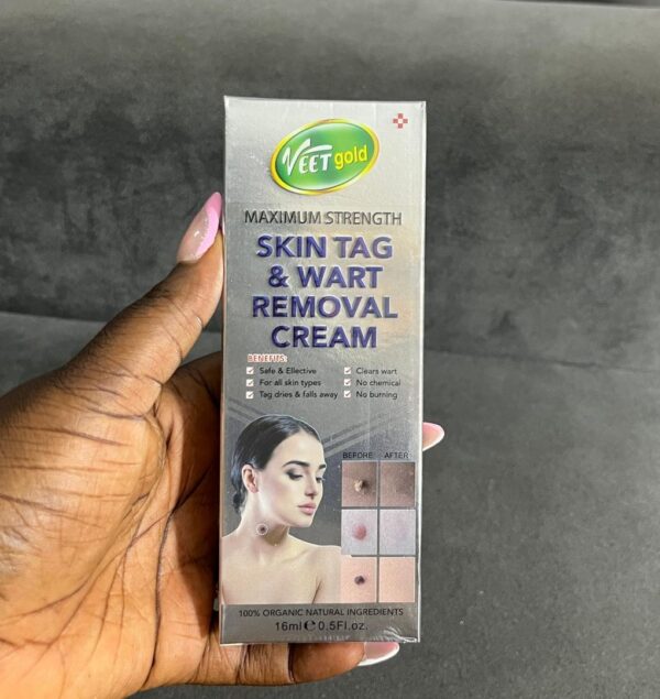 Veet gold skin tag & wart removal cream